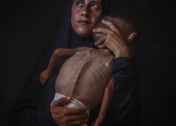 BM: Gazze'nin her yerinde İsrail'in politikaları yüzünden açlık riski var