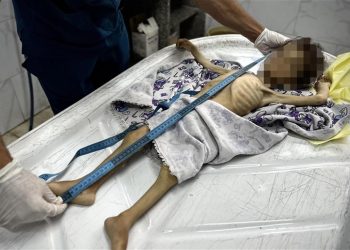 İngiliz patolog: Gazze'deki sefalet bir halkın diğerine neler yapabileceğini gözler önüne serdi