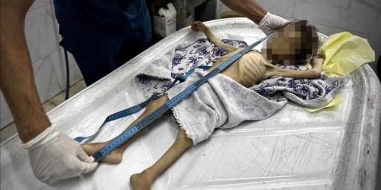 İngiliz patolog: Gazze'deki sefalet bir halkın diğerine neler yapabileceğini gözler önüne serdi