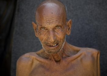 Gazzede son 3 haftada 1000 yetişkin açlık nedeniyle hastanelik oldu