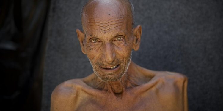 Gazzede son 3 haftada 1000 yetişkin açlık nedeniyle hastanelik oldu