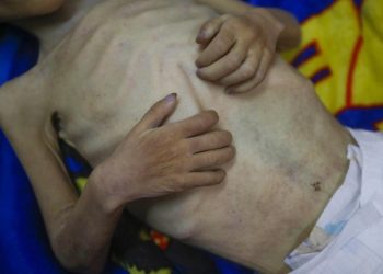 Gazze'de açlıktan ölenlerin sayısı günbegün artıyor