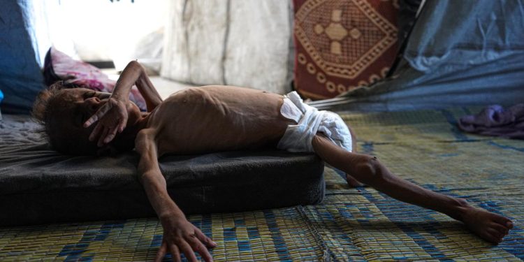 Gazzedeki ABD'li hemşire: İsrail soykırımı Gazze'yi yok ediyor, çocuklar açlıktan ölüyor