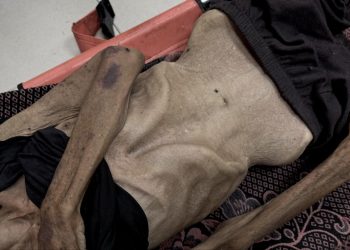 Soykırımın yeni yüzü: Kıtlık