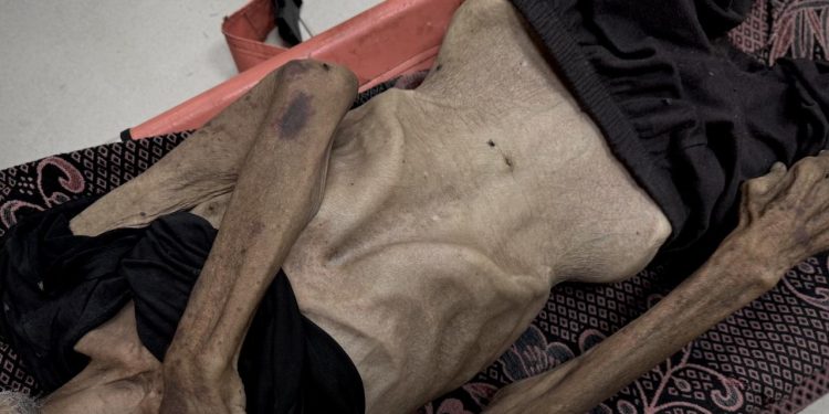 Soykırımın yeni yüzü: Kıtlık