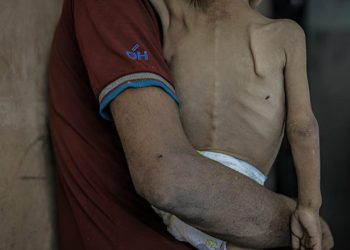 İsrail'in kıtlığı dayattığı Gazzede açlıktan ölenlerin sayısı 263e yükseldi