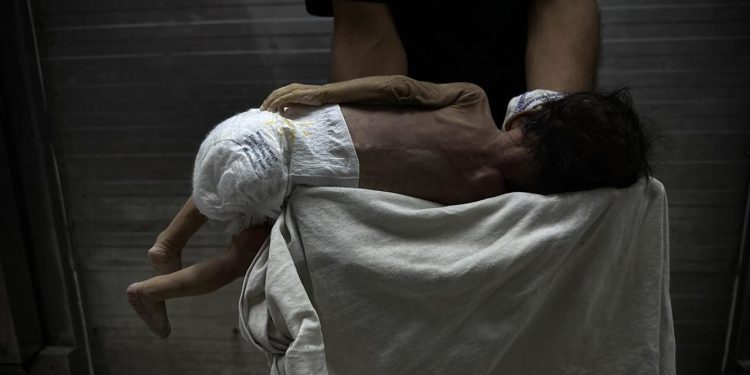 Gazze'nin bebekleri açlıktan ölüyor