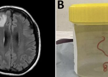 Gölet ve nehirlerde yaşayan solucan, şizofreni tedavisinde kullanılabilir