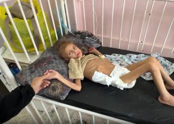 Gazzede yetersiz beslenme sonucu 12 kiloya düşen 7 yaşındaki May yürüme yetisini kaybetti