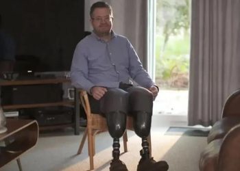 Kendi bacaklarını kesen cerrah dolandırıcılıktan hapse atıldı