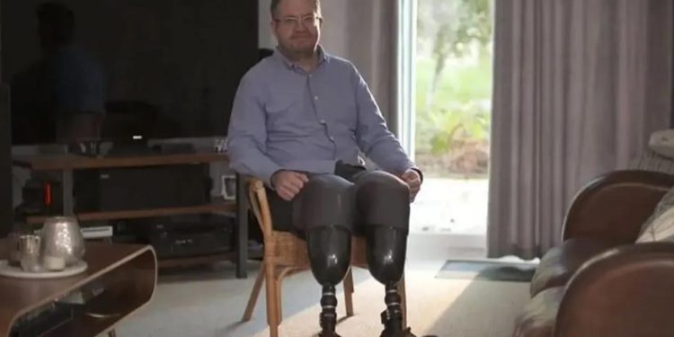 Kendi bacaklarını kesen cerrah dolandırıcılıktan hapse atıldı