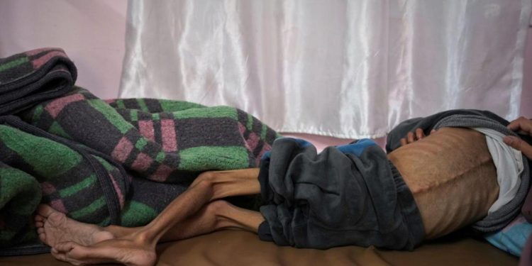 Gazze'de son 24 saatte 3'ü çocuk 9 kişi daha açlıktan hayatını kaybetti