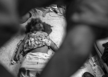 Katil İsrailin saldırıları Gazzede hastaneleri çökertti: Doktorlar ameliyatları anestezisiz yapıyor