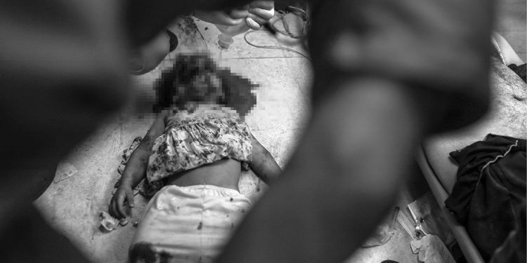 Katil İsrailin saldırıları Gazzede hastaneleri çökertti: Doktorlar ameliyatları anestezisiz yapıyor