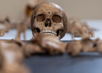 Avustralya'da bir üniversitenin 25 yıl boyunca izinsiz beden parçaları topladığı belirlendi