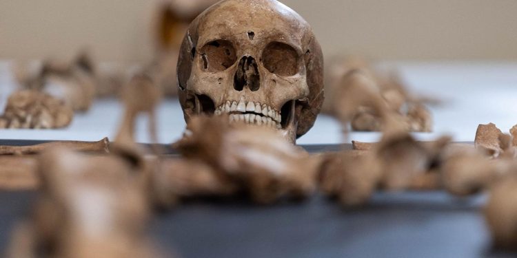 Avustralya'da bir üniversitenin 25 yıl boyunca izinsiz beden parçaları topladığı belirlendi