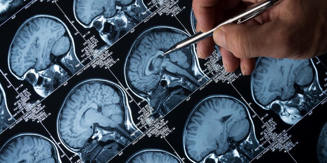 Alzheimer ve kanser, yakında duyamadığımız seslerle tedavi edilebilir