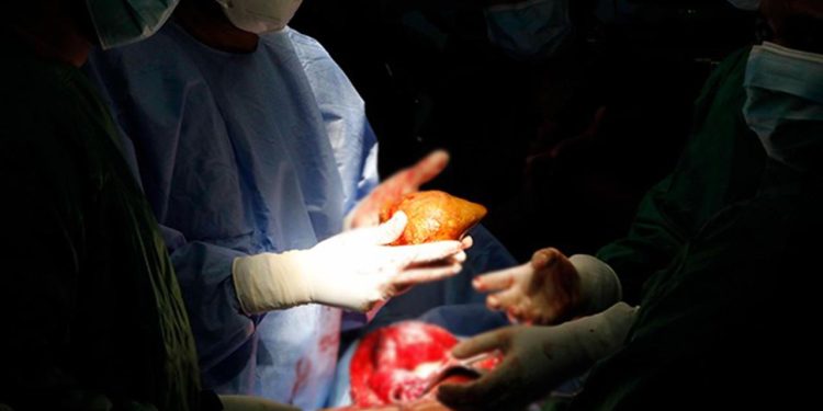 Çığır açan gelişme: Her kan grubuna uyumlu evrensel böbrek geliştirildi