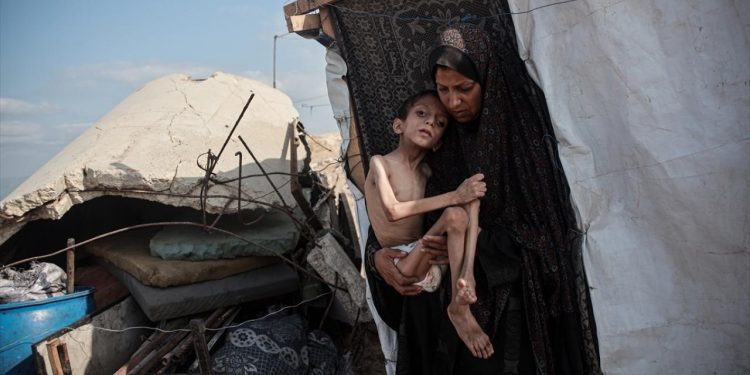 İşgalci İsrail'in ablukasındaki Gazzede açlıktan ölenlerin sayısı 457 oldu