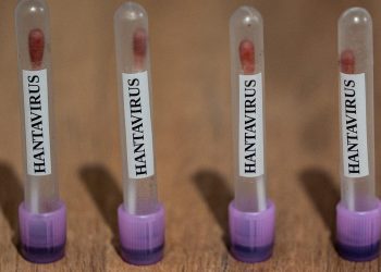ABC: ABD, hantavirüs vakalarını 3. seviye acil durum koduyla takibe aldı
