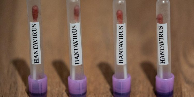 ABC: ABD, hantavirüs vakalarını 3. seviye acil durum koduyla takibe aldı