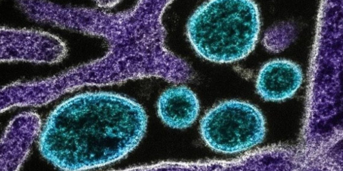 DSÖ, Atlas Okyanusu'ndaki gemide 7 hantavirüs vakası belirlendiğini bildirdi