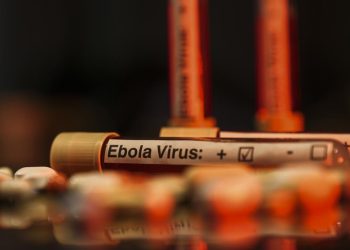 BM: KDC'de etkili olan Ebola salgını 1 milyon kişiyi daha yoksulluğa itecek