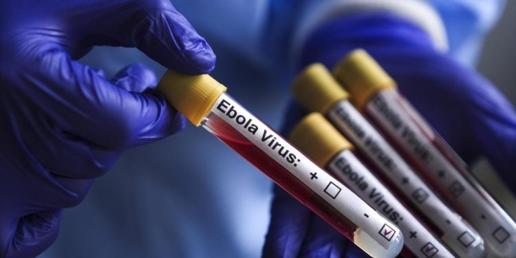 Fransa'da Ebola vakası görüldü