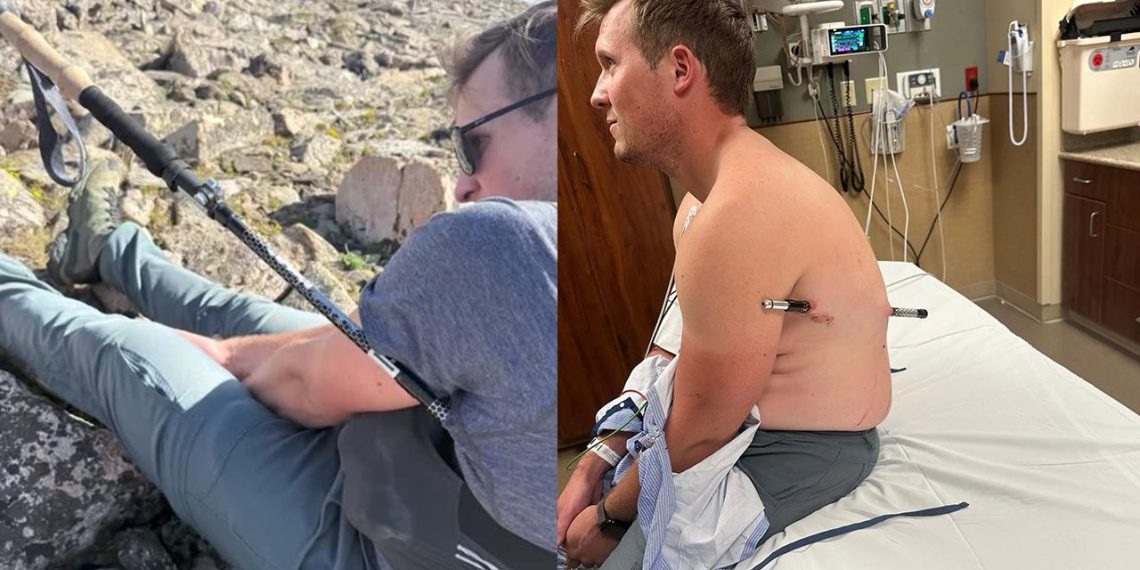 Vücuduna yürüyüş sopası saplanan dağcı 16 kilometre yürüdü