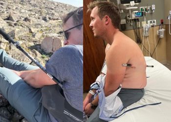 Vücuduna yürüyüş sopası saplanan dağcı 16 kilometre yürüdü