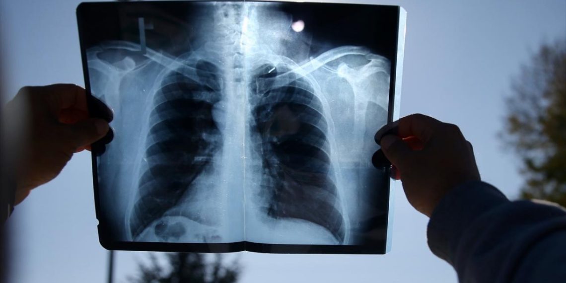 İspanya 114 yıl sonra ülkede ilk kez gözlemlenecek tam güneş tutulmasına hazırlanıyor