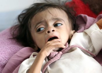 BMden Yemende insani kriz uyarısı