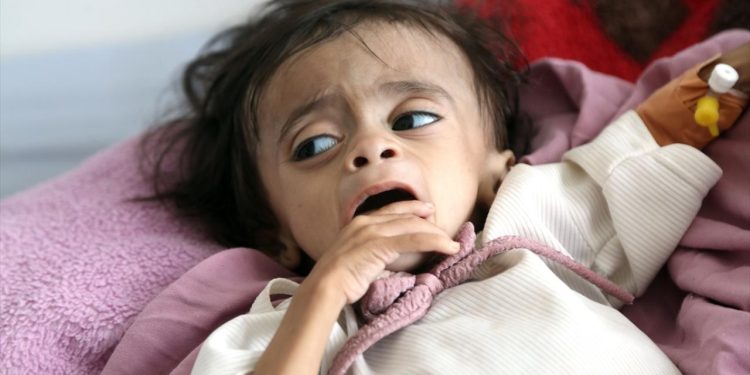 BMden Yemende insani kriz uyarısı